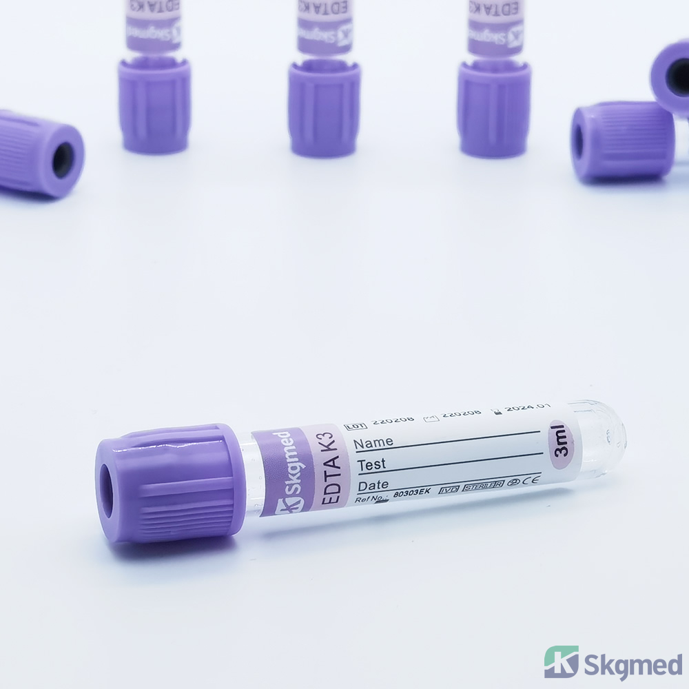 Vákuová skúmavka na odber krvi EDTA K3 antikoagulovaná vzorka krvi