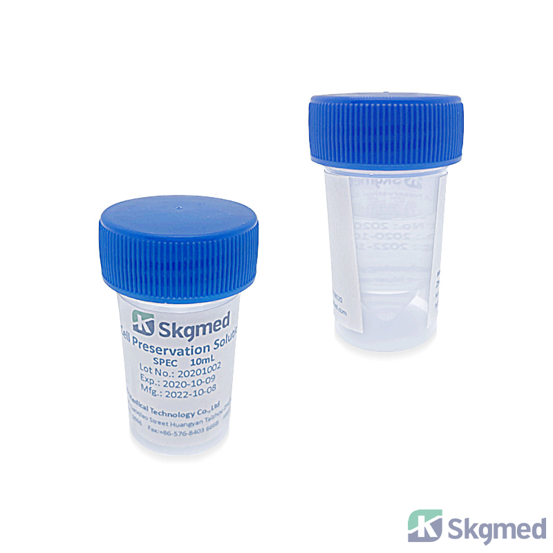 TCT Thin Layer Cell Preservation Solution