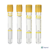 Vacuum Blood Collection Tube ACD Tube
